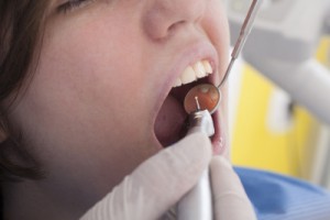 Zahnarztbesuche können teuer werden - Zahnzusatzversicherungen übernehmen in vielen Fällen weiterführende Leistungen.